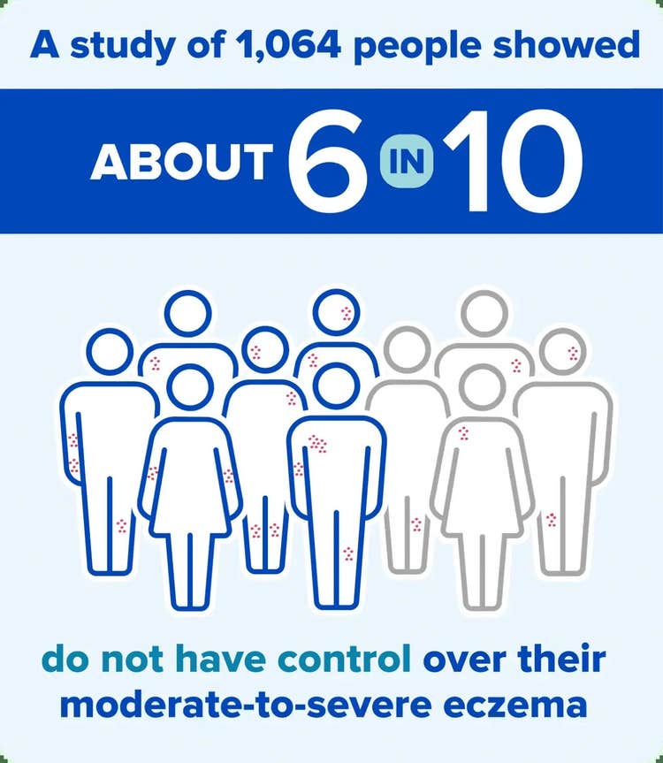 A study of 1064 people showed that about 6 in 10 people do not have adequate control over their moderate-to-severe eczema