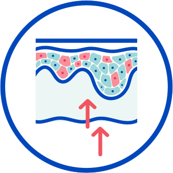 How CIBINQO® (abrocitinib) works inflammation