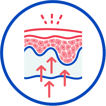 How CIBINQO (abrocitinib) works immune response