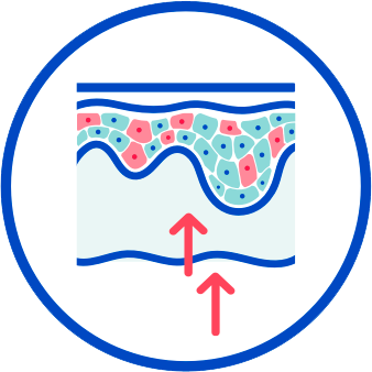 how does CIBINQO™ (abrocitinib) work